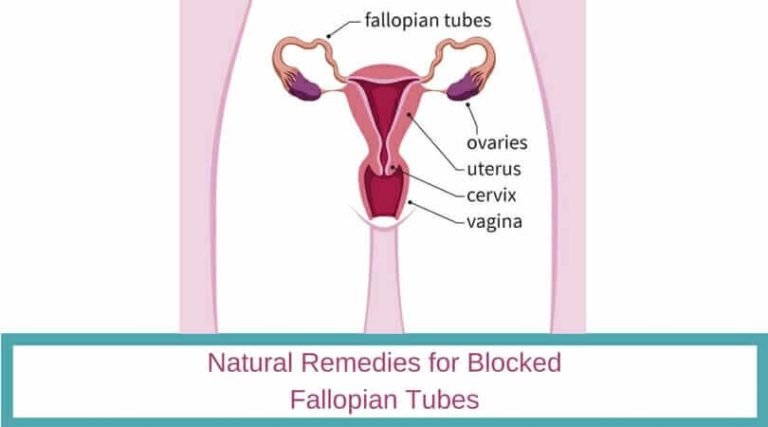 Get Natural Remedies For Blocked Fallopian Tubes In Women 5634